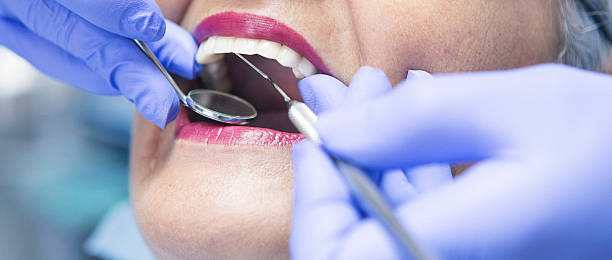 Best Emergency Wisdom Teeth Removal in Starke, FL